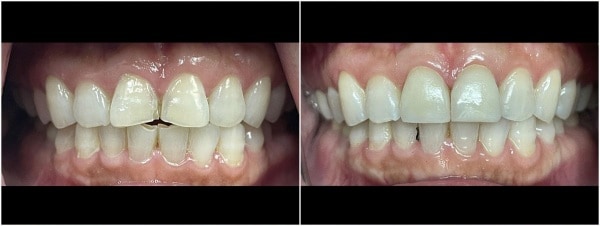 fang-y-case-1