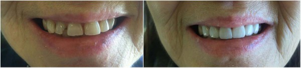 jannette2-out-border-3