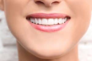 Dental Bonding Beverly Hills