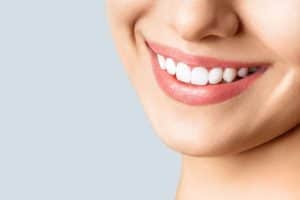 Dental Bridges Beverly Hills