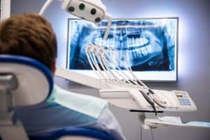 Digital X-Rays Beverly Hills