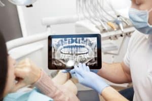 Dental X-Rays Beverly Hills