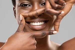 In-office Teeth Whitening Beverly Hills
